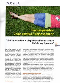 Piernas pesadas. Visi&oacute;n est&eacute;tica/ Visi&oacute;n vascular