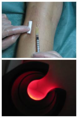 Tratamiento para la microesclerosis - Especialista en Medicina Vascular y Angiolog&iacute;a - Dra. Maya Gracia Graells