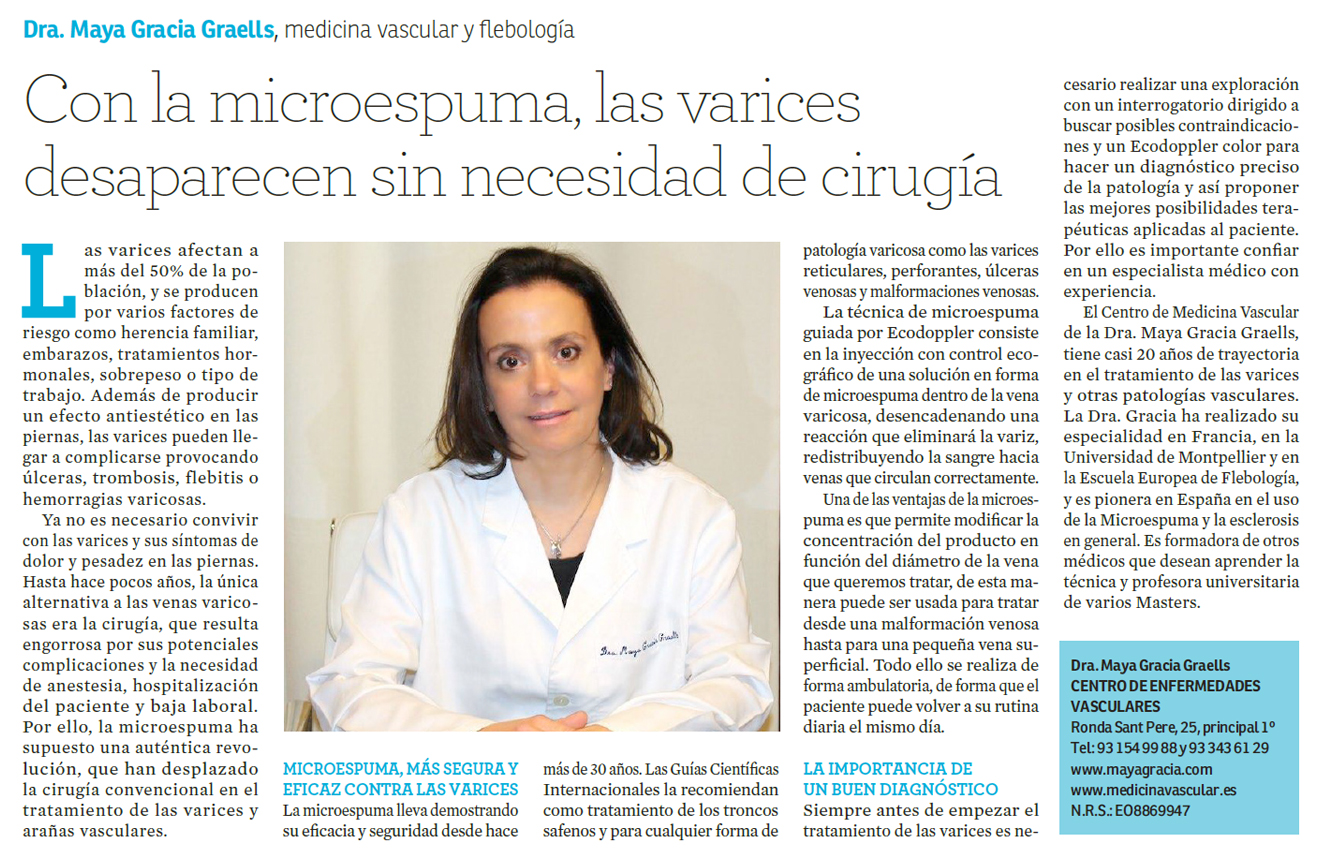 Con la microespuma, las varices desaparecen sin necesidad de cirugía